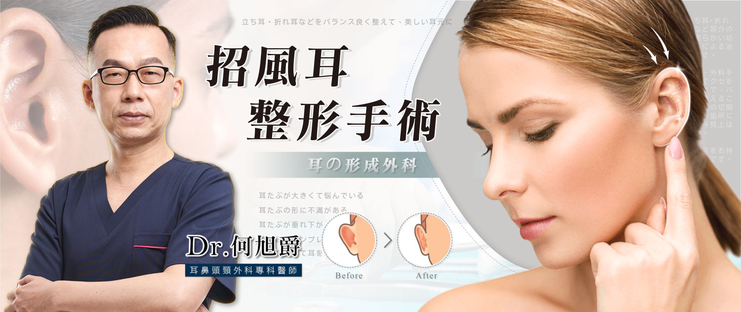 台南招風耳朵整形手術權威醫師推薦何旭爵醫師