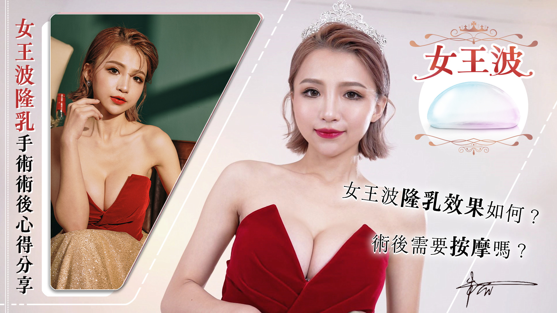 台南女王波權威醫師推薦價位費用01