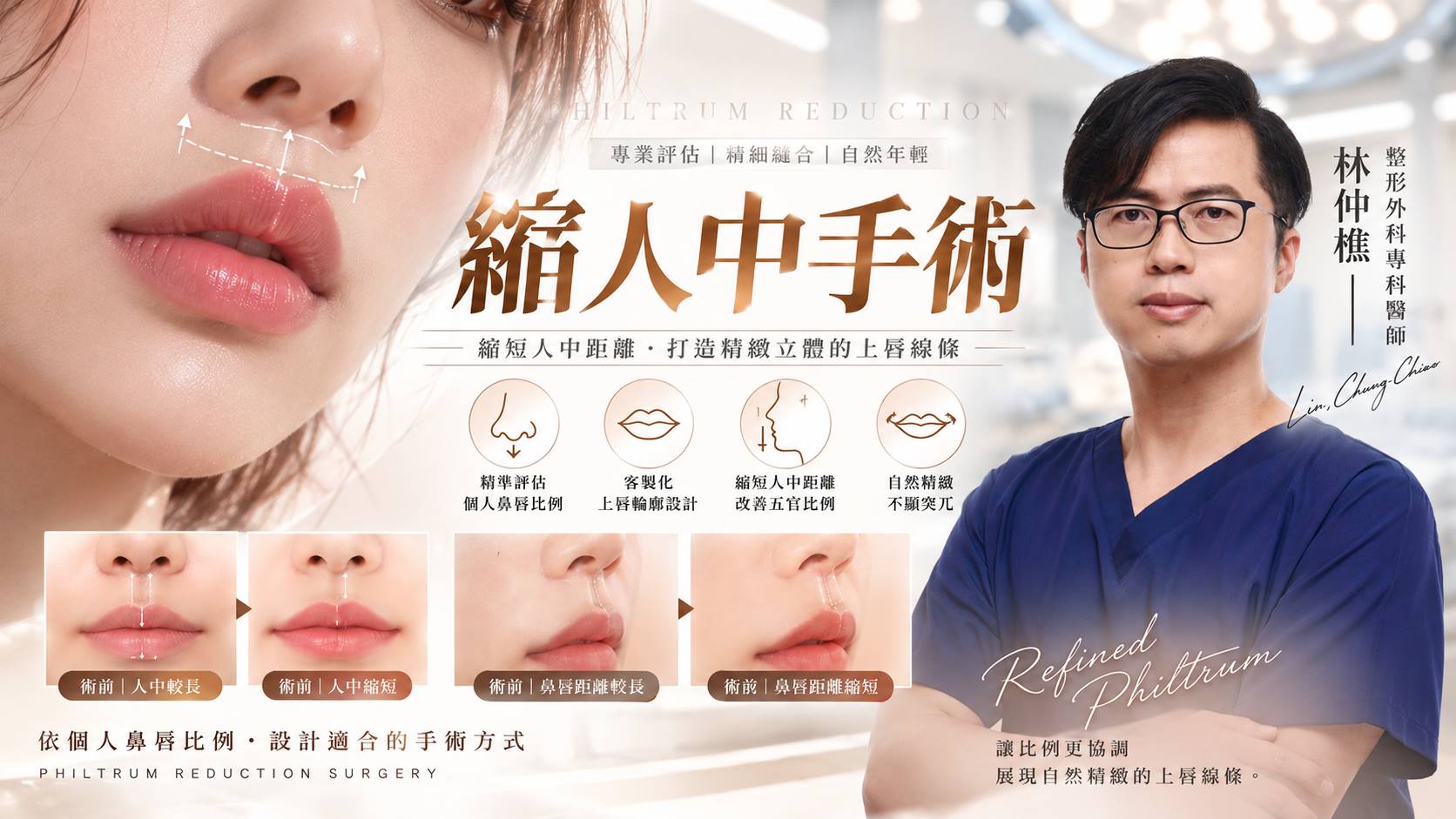 台南縮人中縮短手術權威醫師推薦價格費用介紹003