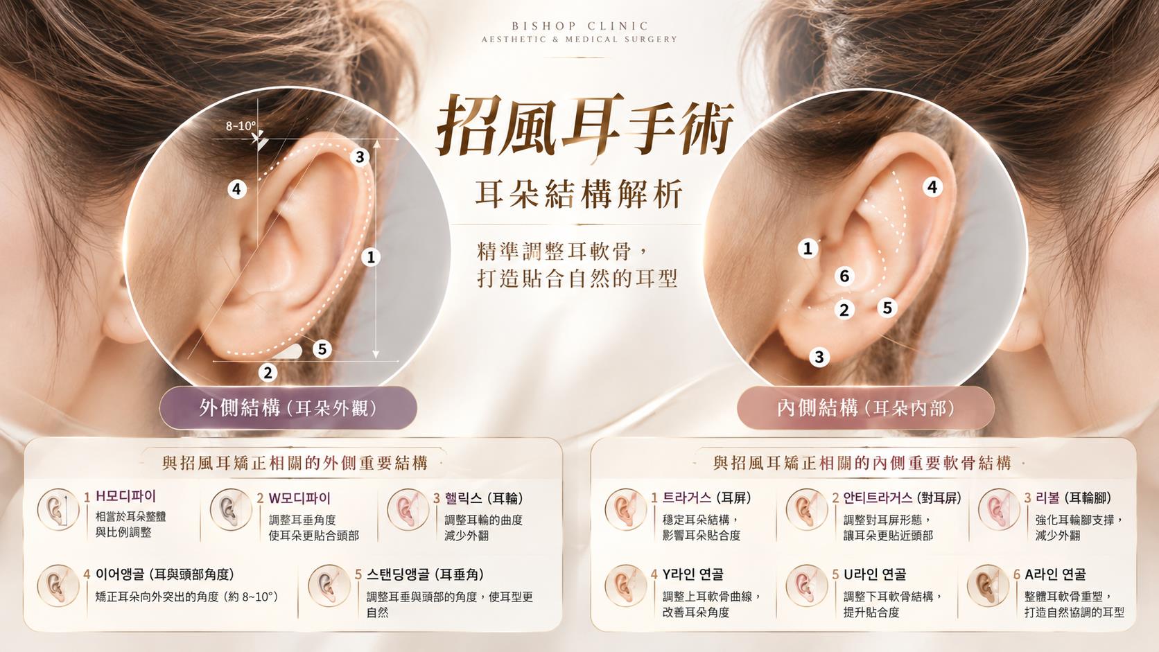 台南耳朵整形招風耳手術權威醫師推薦價格費用多少006