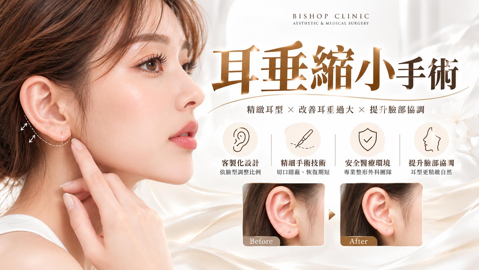 台南耳垂整形手術權威醫師推薦價格費用多少003